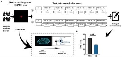 Brain Activation During Processing of Depression Emotion in College Students With Premenstrual Syndrome in China: Preliminary Findings